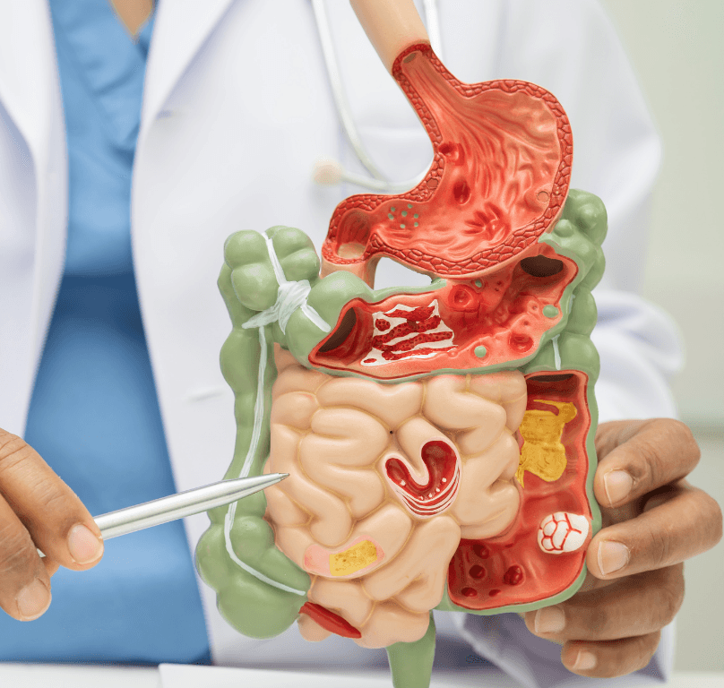 PROFILO GASTRO-INTESTINALE